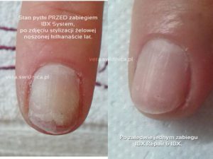 dorota_przed_i_po_vera_pro.440x330